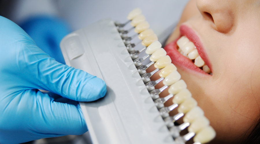 dental implants ballantyne