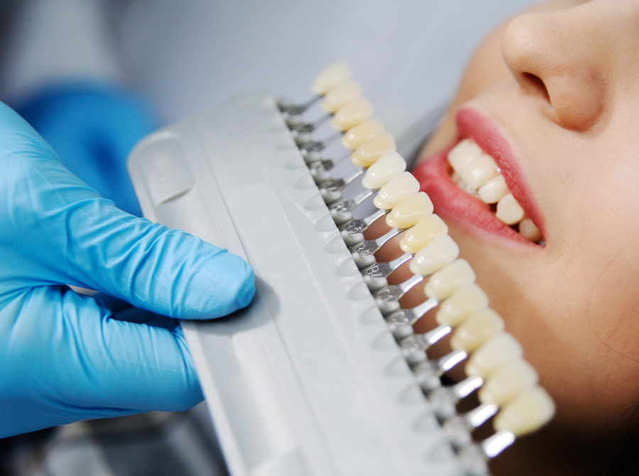 dental implants ballantyne