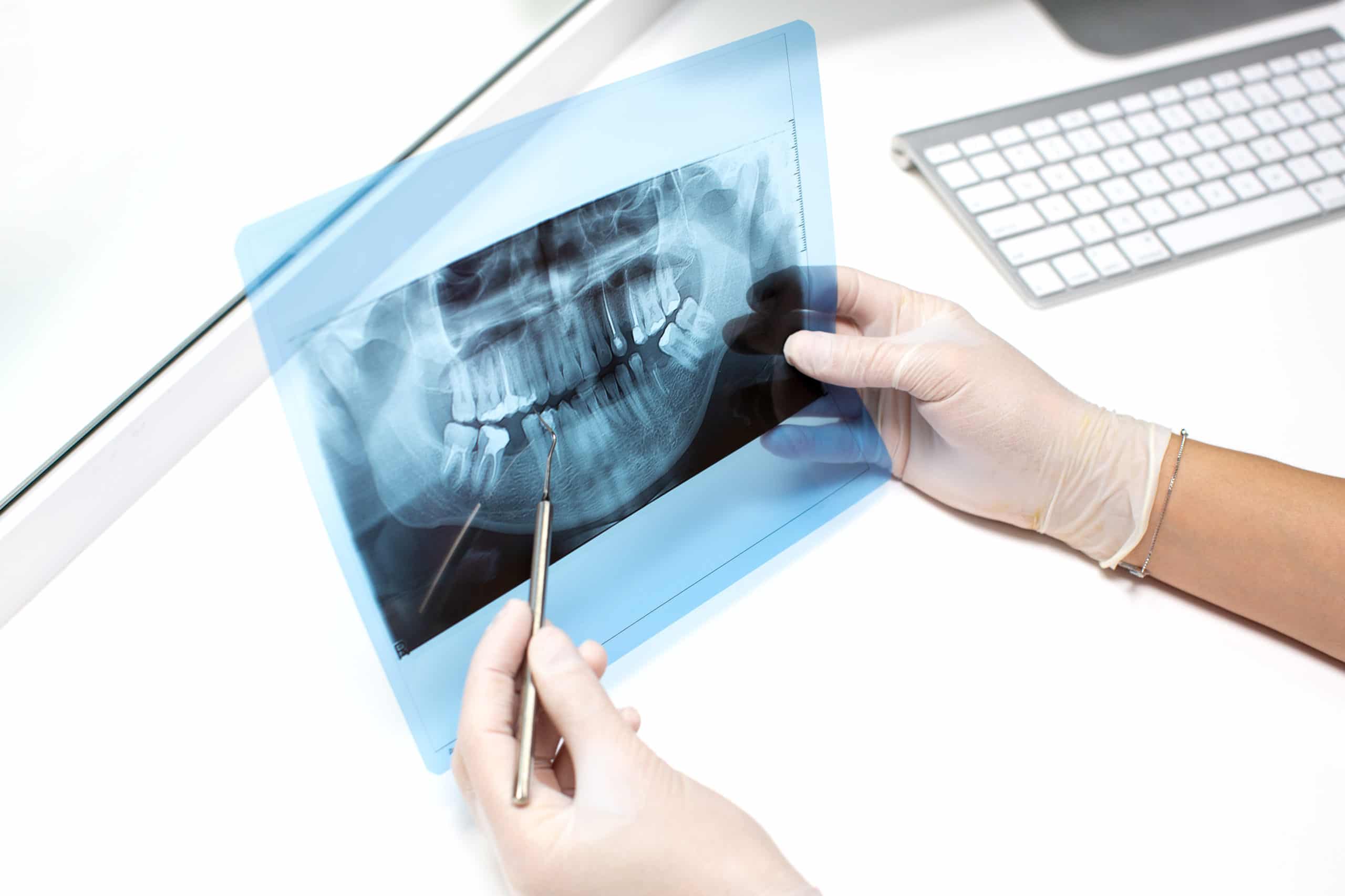 Taking a Closer Look at the Different Types of Dental XRays and Their